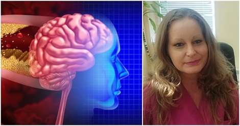 Инсулт, д-р Милкова, невролог